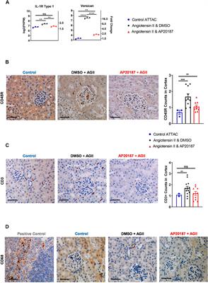 Low Dose Chronic Angiotensin II Induces Selective Senescence of Kidney Endothelial Cells